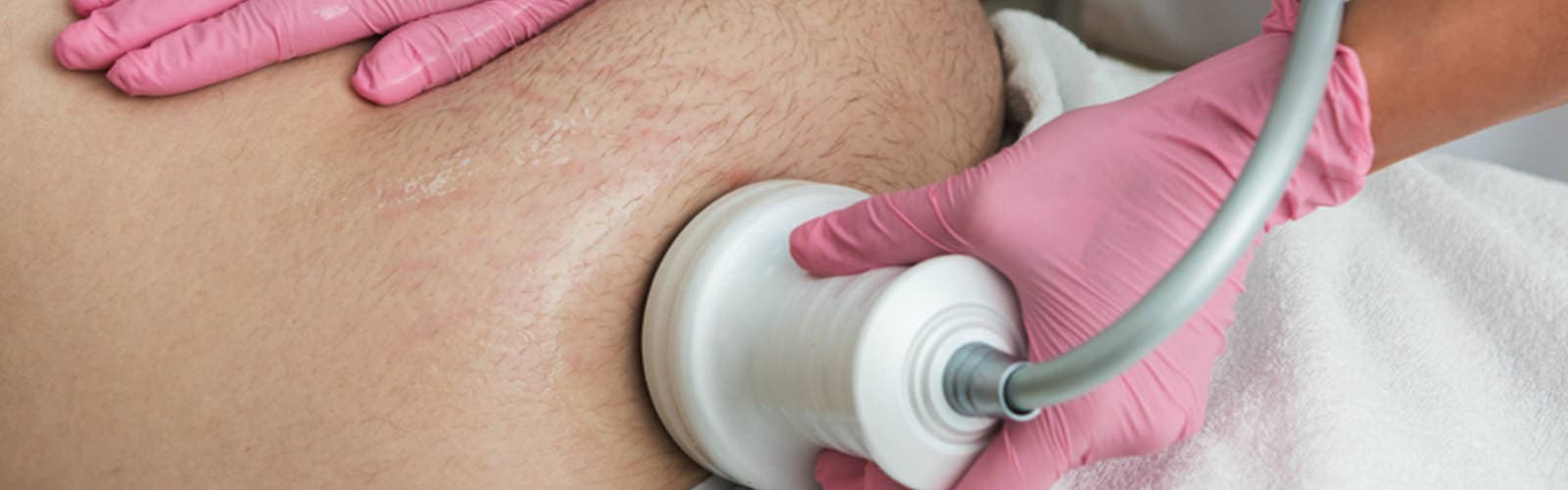 cellulite reduction treatment in ibiza