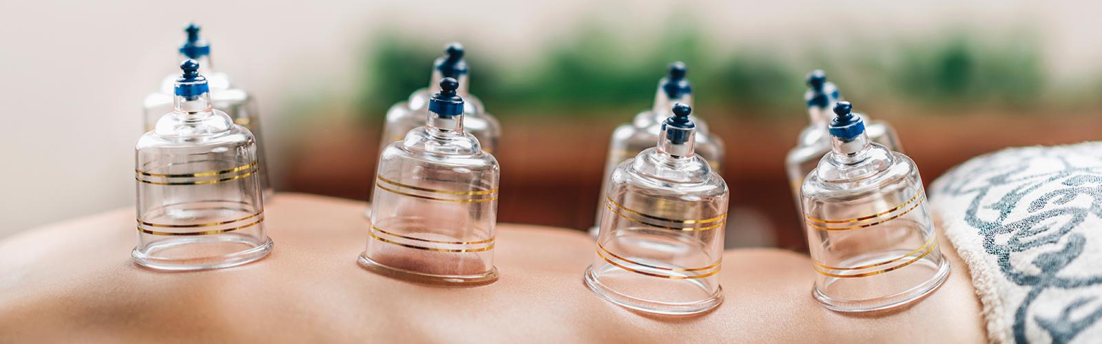 cupping massage therapy in ibiza